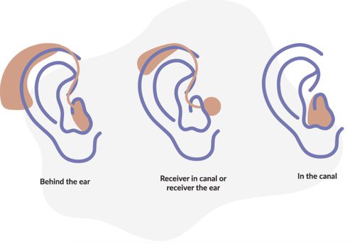 Hearing aid types