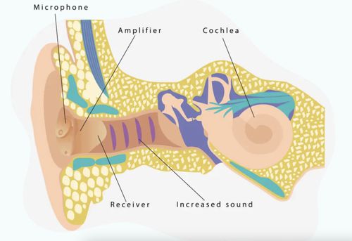 How hearing aids work